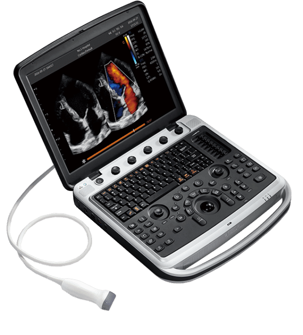 CHISON SonoBook portable ultrasound